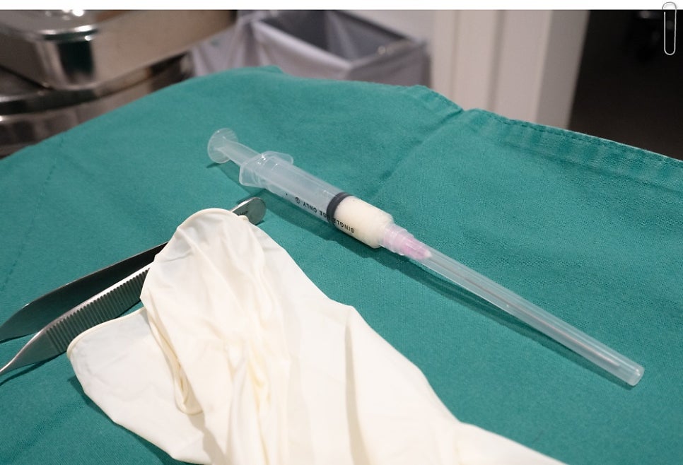 초록색 수술포 위에 놓인 단발성 주사기(카테터 형태), 수술용 라텍스 장갑, 금속 겸자(포셉)이 놓인 클로즈