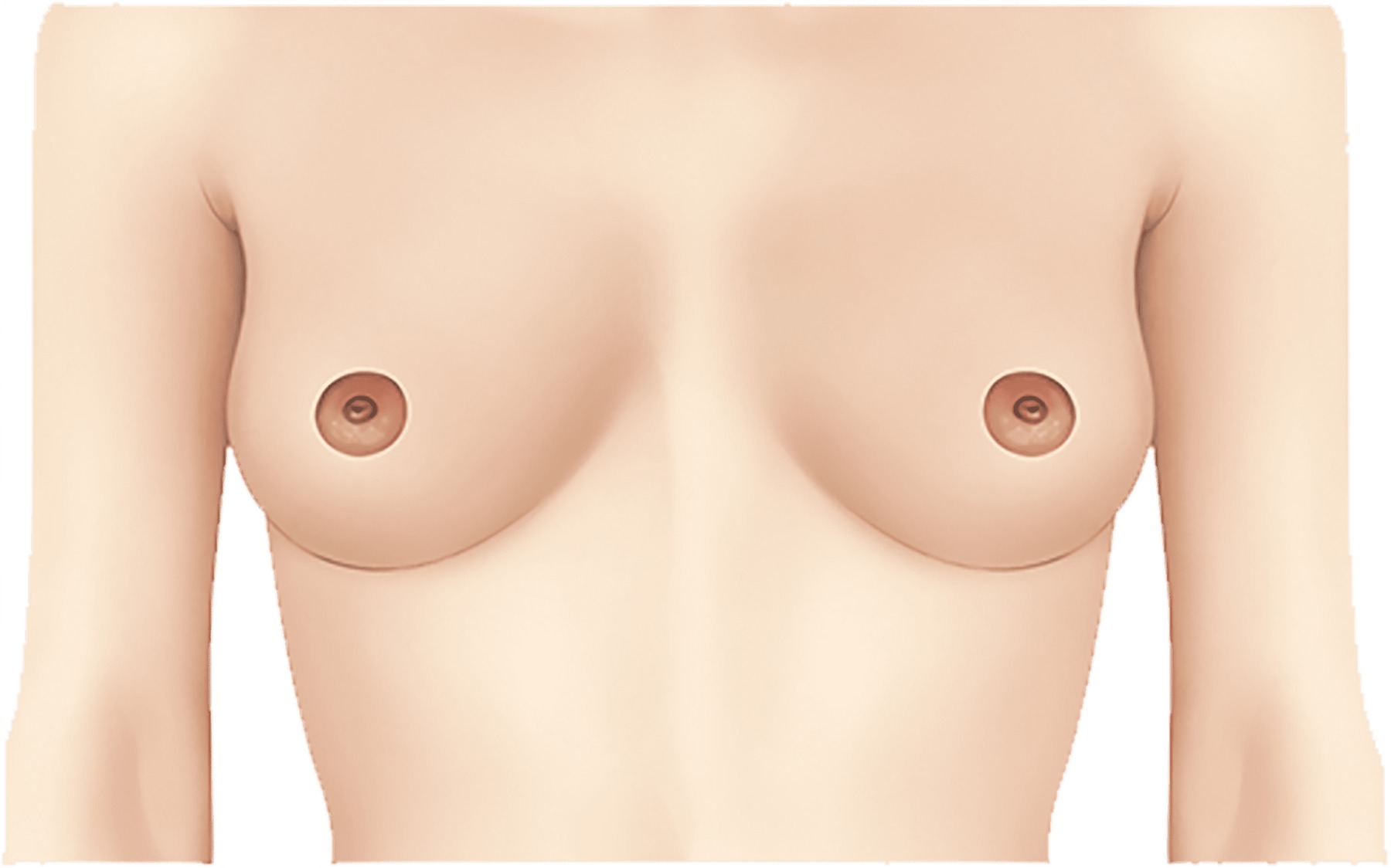 실린더형 레이저 장비(화면에 파라미터 표시) 앞에서 흰 가운을 입은 여성 의료진이 미소지으며 파란색 부직포