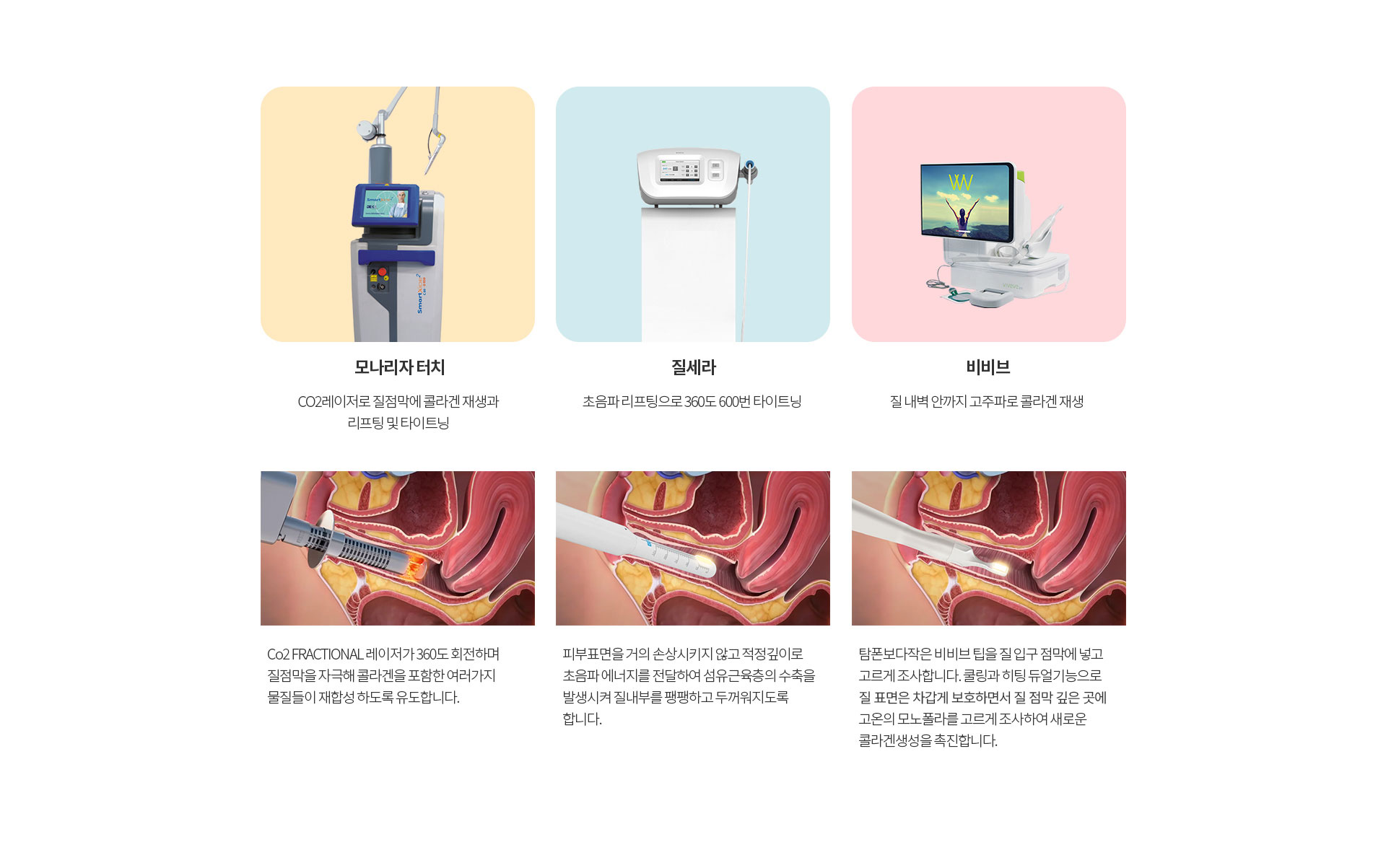 레이저 시술 안내