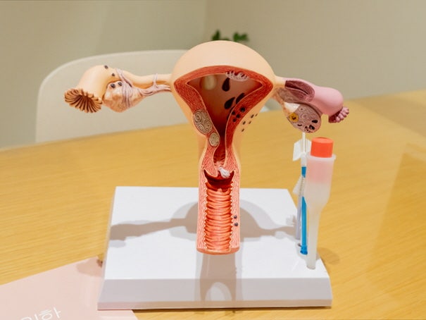 자궁 해부 모형