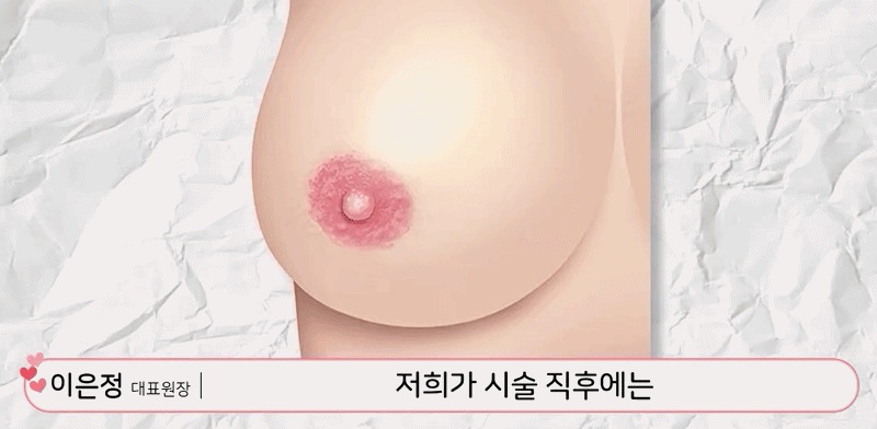 유두미백4