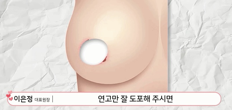유두미백6