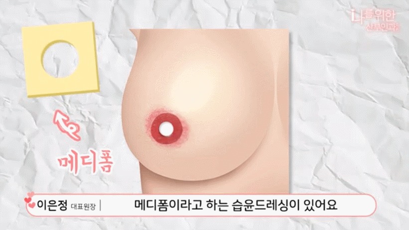 유두미백3