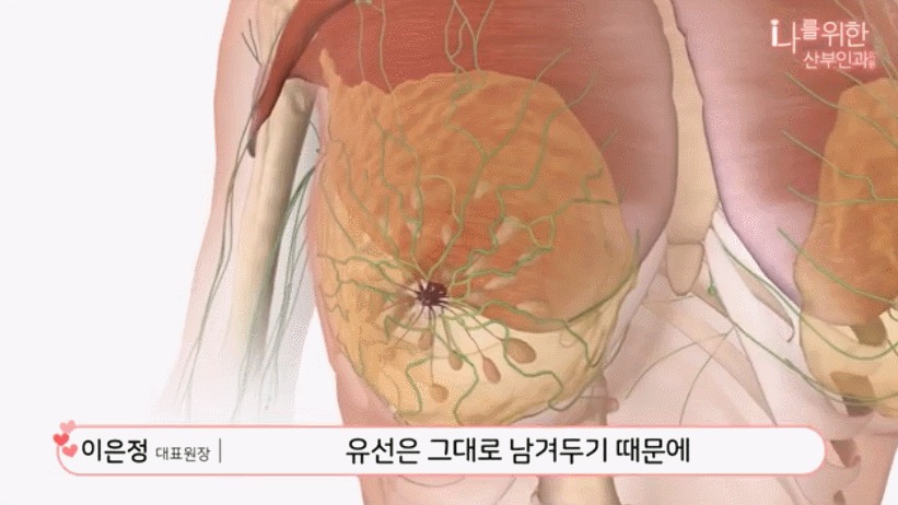 유두미백5
