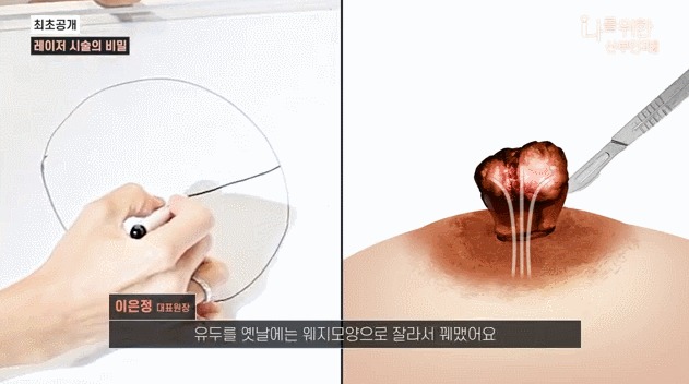 유두미백3