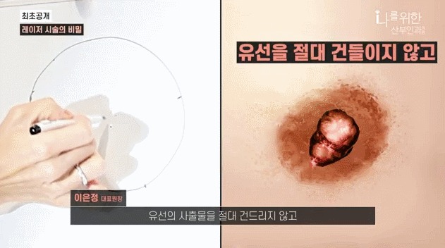 유두미백6