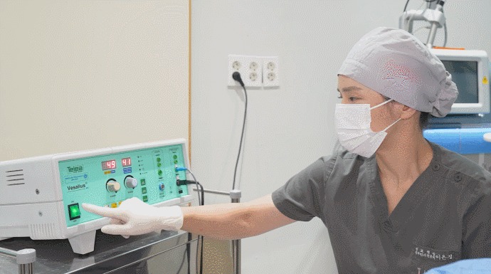 소음순수술4