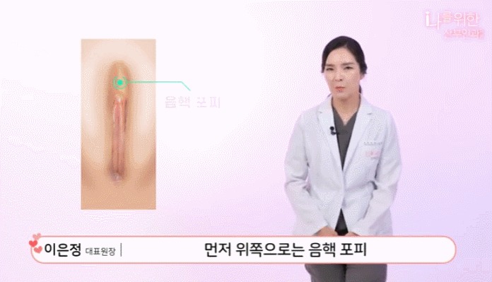 소음순수술2