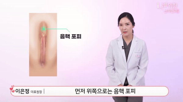 소음순수술2