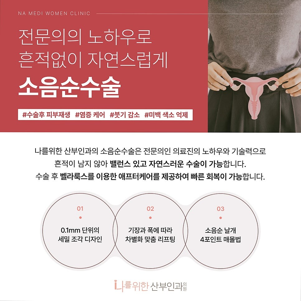 소음순수술4