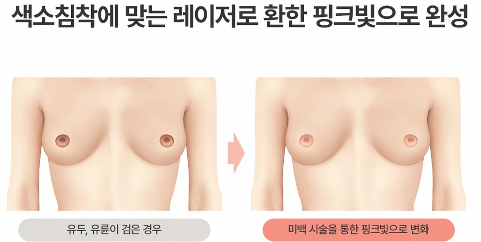 유두미백7
