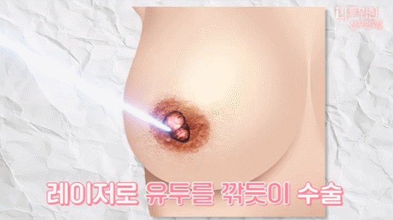 유두미백5