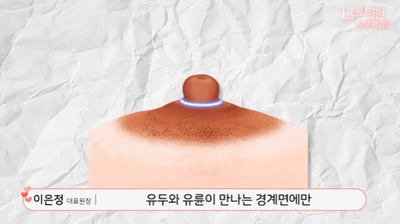 유두미백6