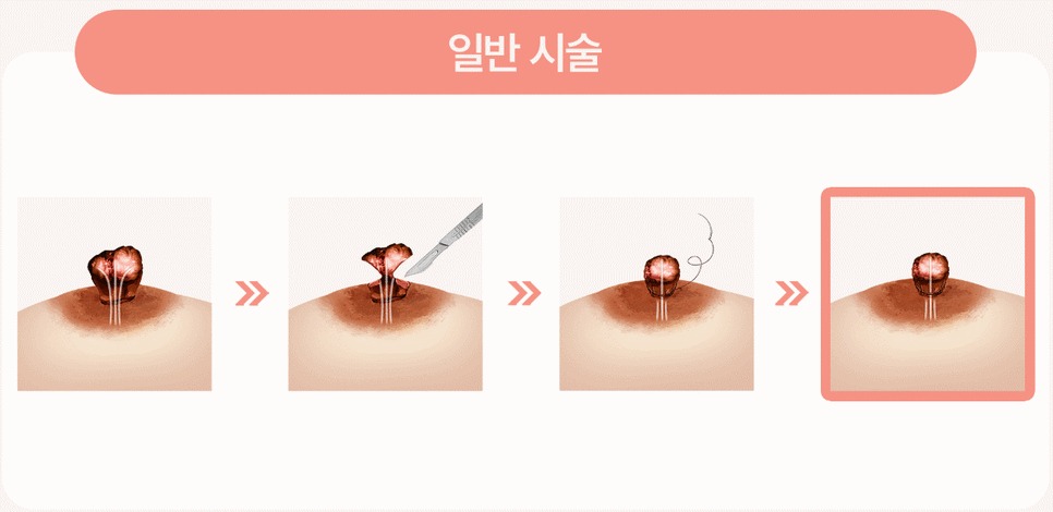 유두미백7