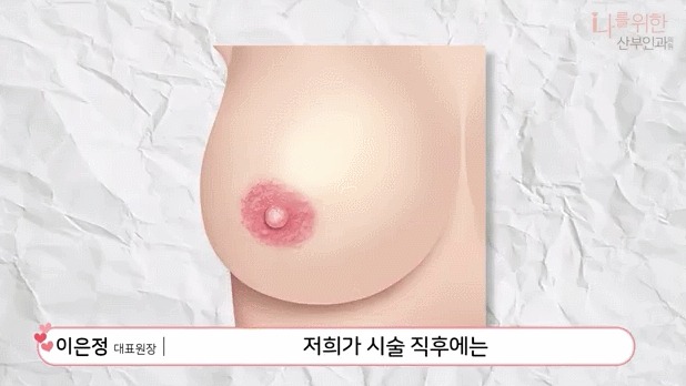 유두미백4
