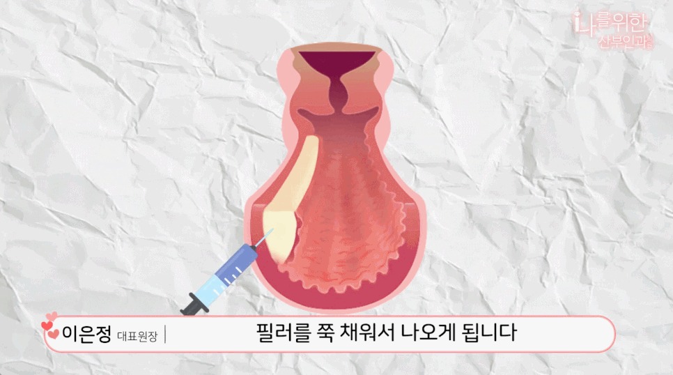 강남질필러8
