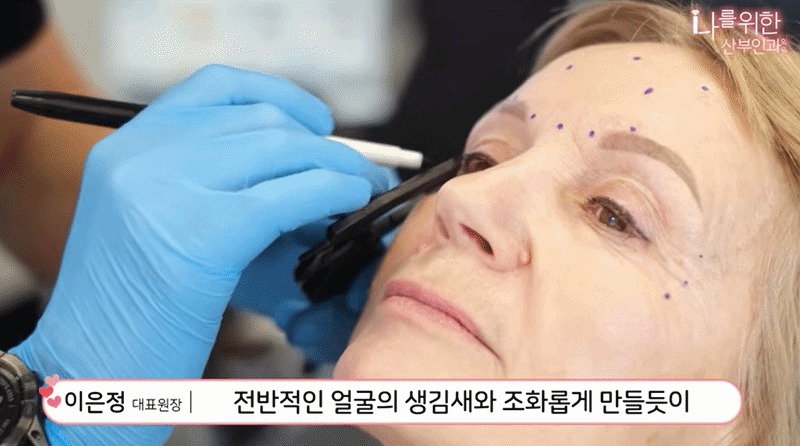 소음순수술4