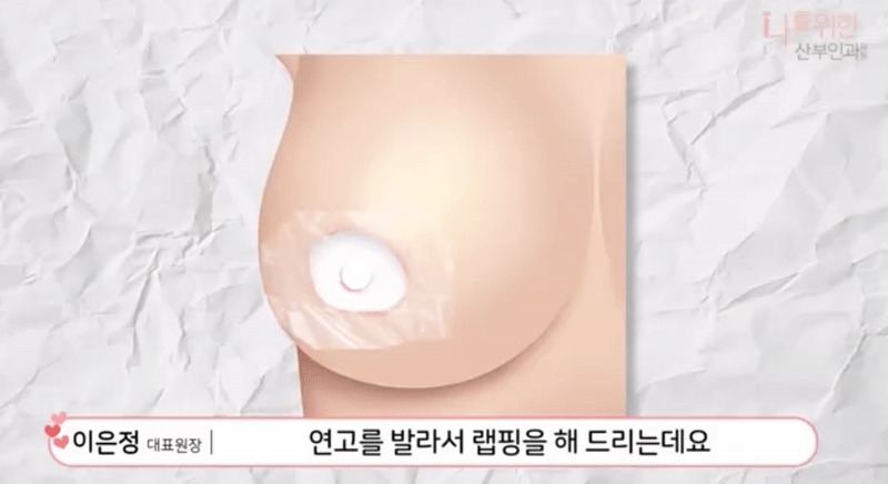 유두미백4