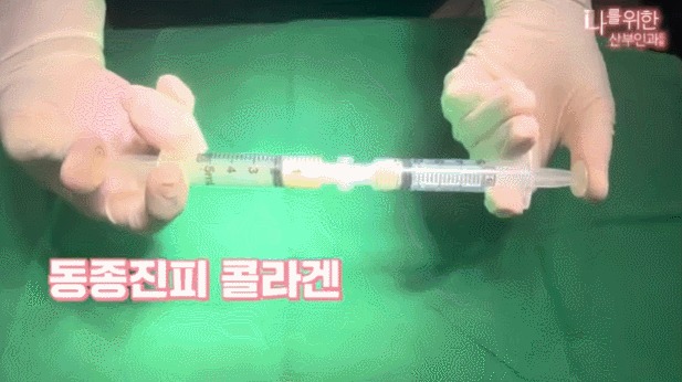 강남질필러5