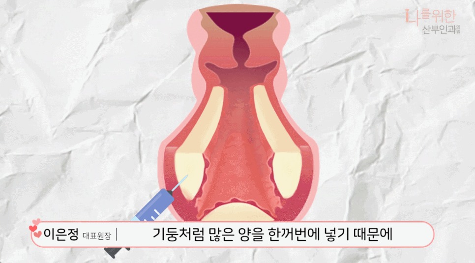 강남질필러9