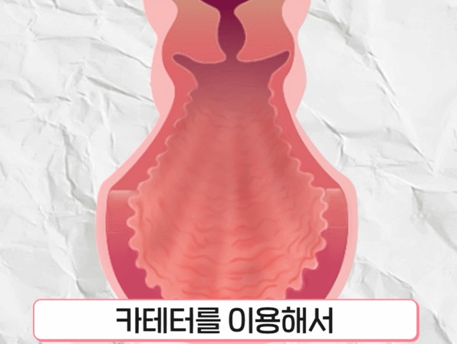 강남질필러5